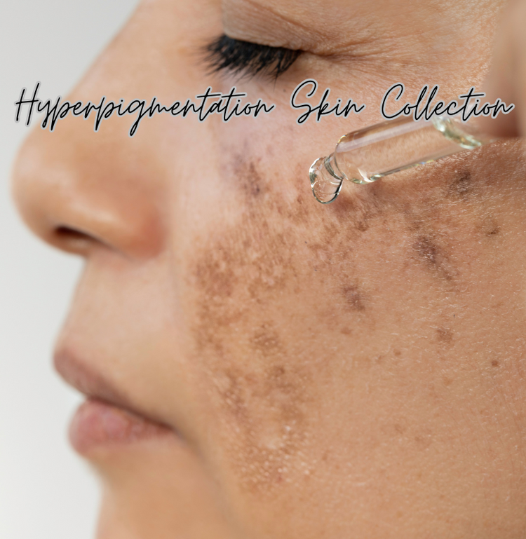 Hyperpigmentation